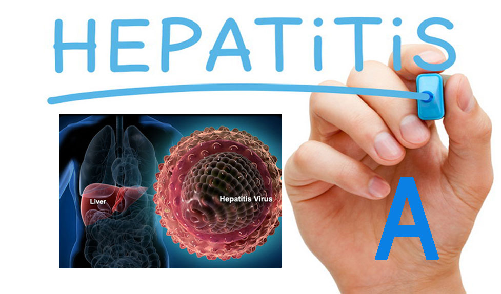Dinkes Waspadai Sebaran Hepatitis A
