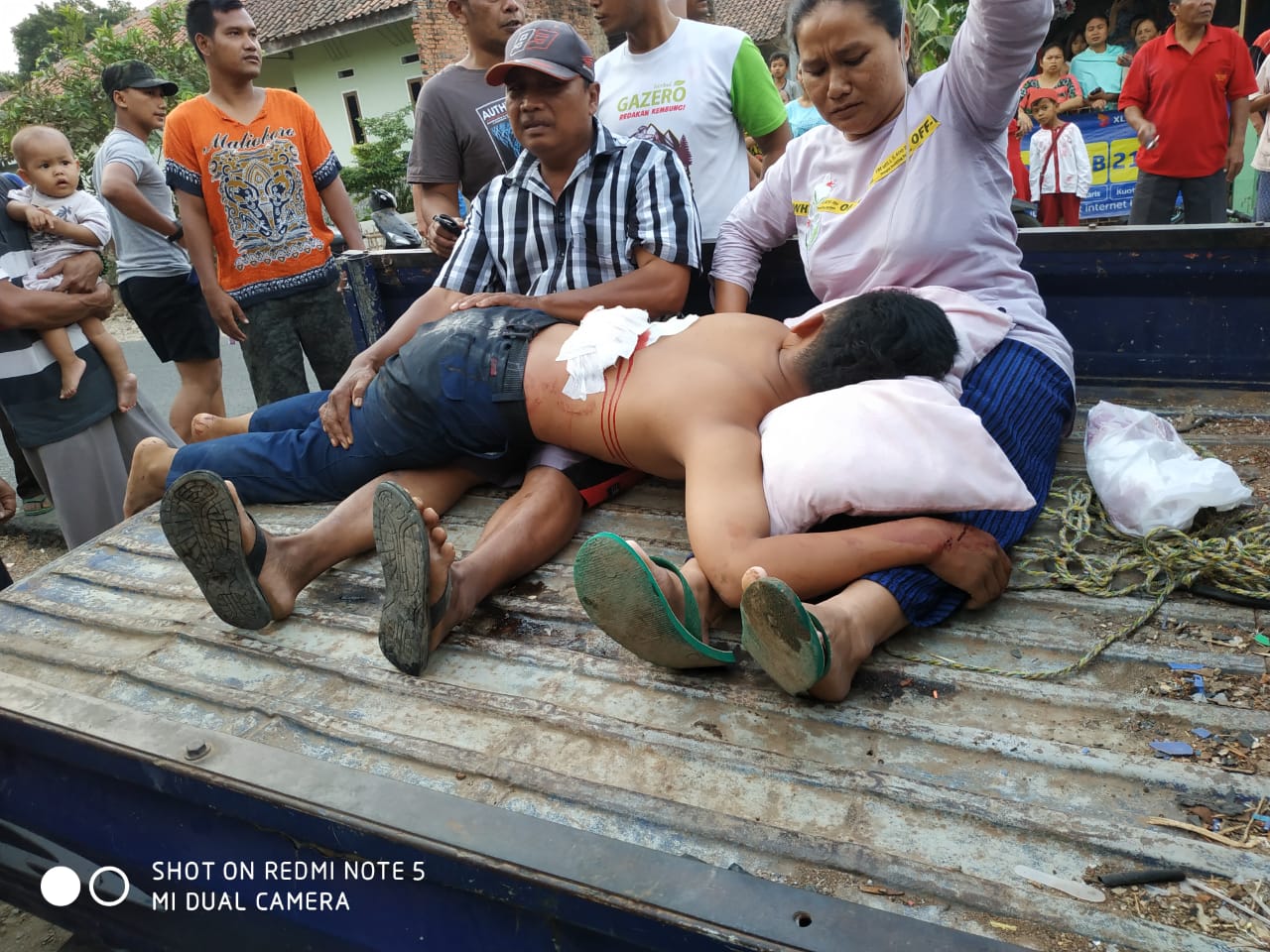 Beredar Foto Siswa SMP Terluka, Polisi: Tidak Meninggal, Dirawat di RS