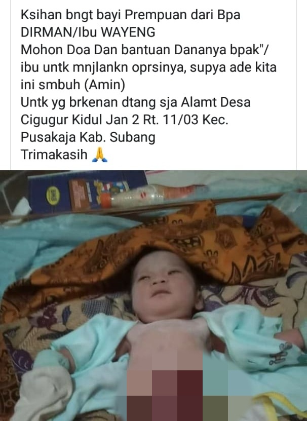 Dijadwalkan Operasi, Bayi Lahir dengan Kelainan di Perut Keburu Meninggal