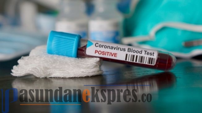 Dinas Kesehatan Bandung Barat: Ada 32 ODP Virus Corona