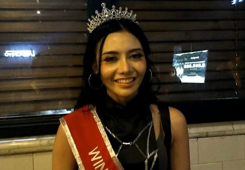Anggy Novia, Si Manis Pemenang Miss Popular 2021!