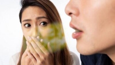 Penyebab Bau Mulut yang sering di Alami
