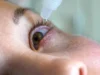 Jangan Dikucek! Ada 6 Cara Mengatasi Mata Gatal, Langsung Sembuh! (Sumber Gambar via Precision Eye Care)