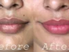 Cara Menghilangkan Bibir Hitam dan Cara Mengembalikan Warna Asli