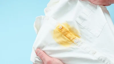 Tips Jitu Menghilangkan Noda Kuning di Baju Putih yang Aman dan Efektif!